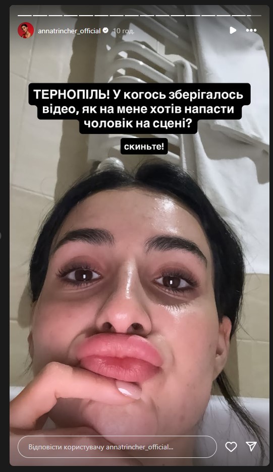 Невідомий спробував напасти на співачку Анну Трінчер у Тернополі