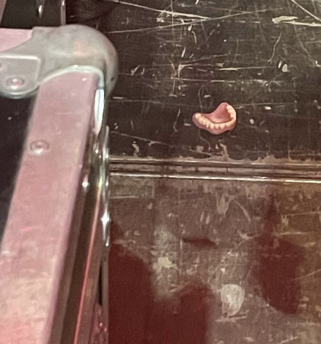 Співак Артем Пивоваров показав загублену на його концерті щелепу